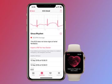 Apple libera iOS 13.6 com eletrocardiograma para Apple Watch no Brasil