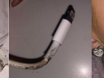 Carregador de iPhone pega fogo e queima rosto de usuária
