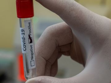 Ministério da Saúde admite ineficácia de 'kit covid' com cloroquina