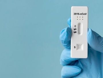 Ministério da Saúde intensifica plano de testes de covid-19
