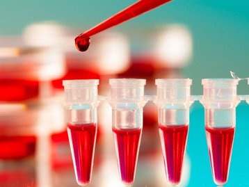 HIV: os avanços e gargalos para 2023