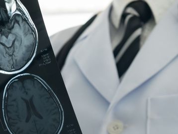 Modelo de aprendizado de máquina prevê AVC no momento da triagem