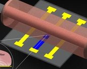 Nova técnica diminui a dor provocada por implantes cerebrais