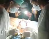 Sem luz, médico termina cirurgia cardíaca com flash de smartphones [vídeo]