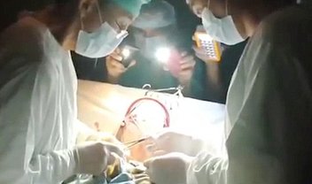 Sem luz, médico termina cirurgia cardíaca com flash de smartphones [vídeo]