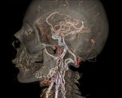 Nova máquina de tomografia computadorizada produz imagens impressionantes