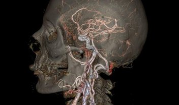 Nova máquina de tomografia computadorizada produz imagens impressionantes