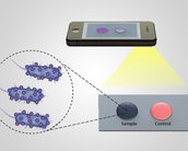 Cientistas desenvolvem teste para HIV feito pela câmera do seu smartphone