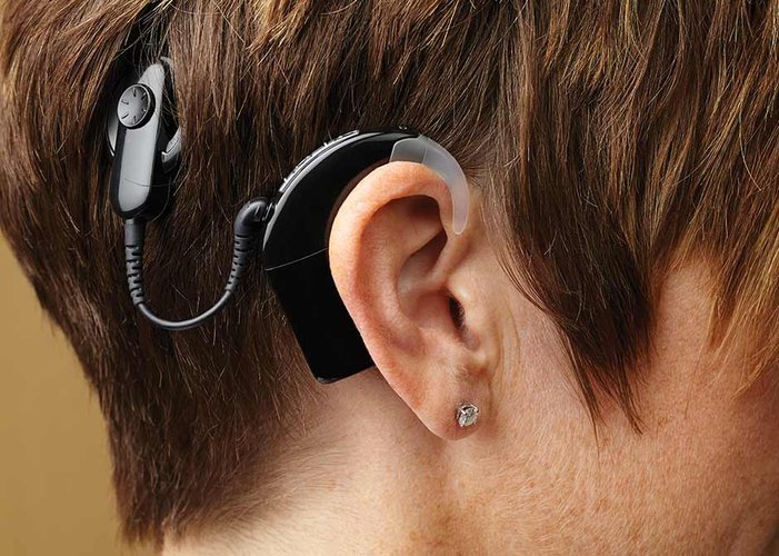 cochlear