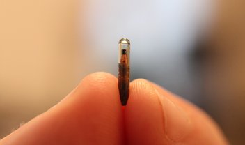 Exclusivo: como tive um chip implantado na mão e me tornei um ciborgue