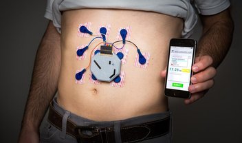 Medicina do futuro! Wearable ajuda pessoas com problemas digestivos