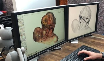 Modelos 3D prometem facilitar estudos de anatomia