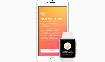 Apple Watch pode identificar alterações de ritmo cardíaco, mostra estudo