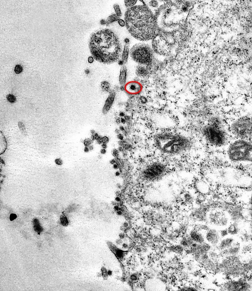 Usando sua "coroa", o vírus (os pequenos pontos pretos na imagem) se liga à membrana celular.