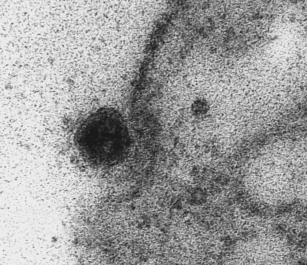 Ao enganar o receptor da enzima, o vírus consegue "permissão" para entrar na célula.