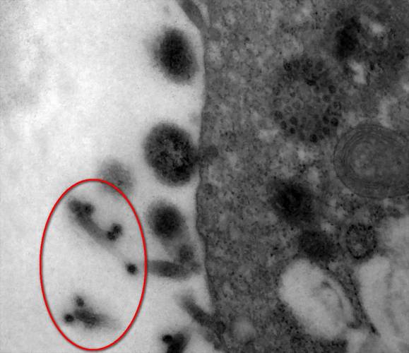 Por fim, a célula infectada se rompe e milhares de cópias do SARS-CoV-2, ainda arrastando pedaços da membrana, seguem para reiniciar o ciclo.