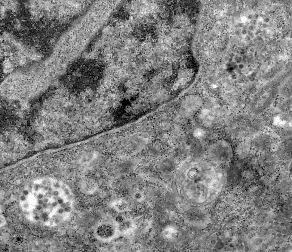 No canto inferior esquerdo (círculo claro), é possível ver uma célula, morta e infestada de vírus.