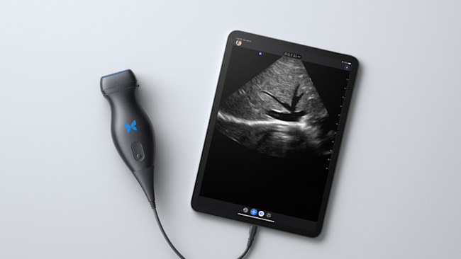 O ultrassom portátil ajuda a verificar as condições do pulmão.
