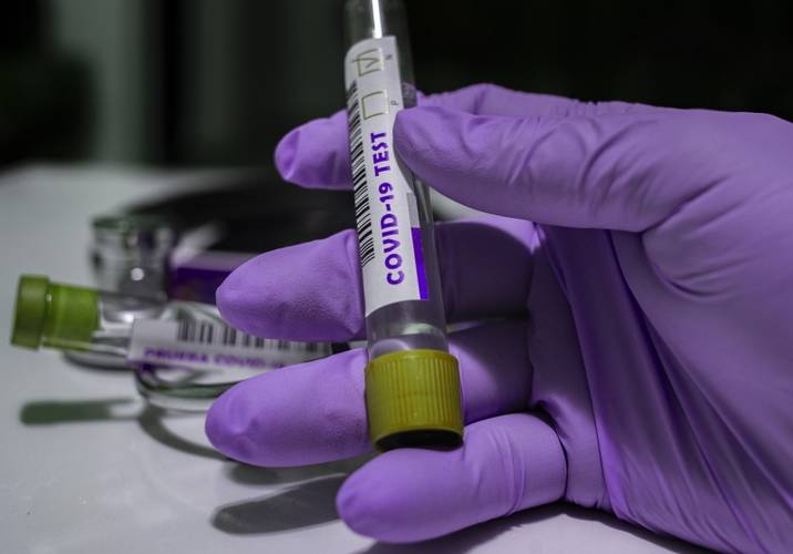 Ainda não se sabe quanto tempo dura a imunização após a infecção