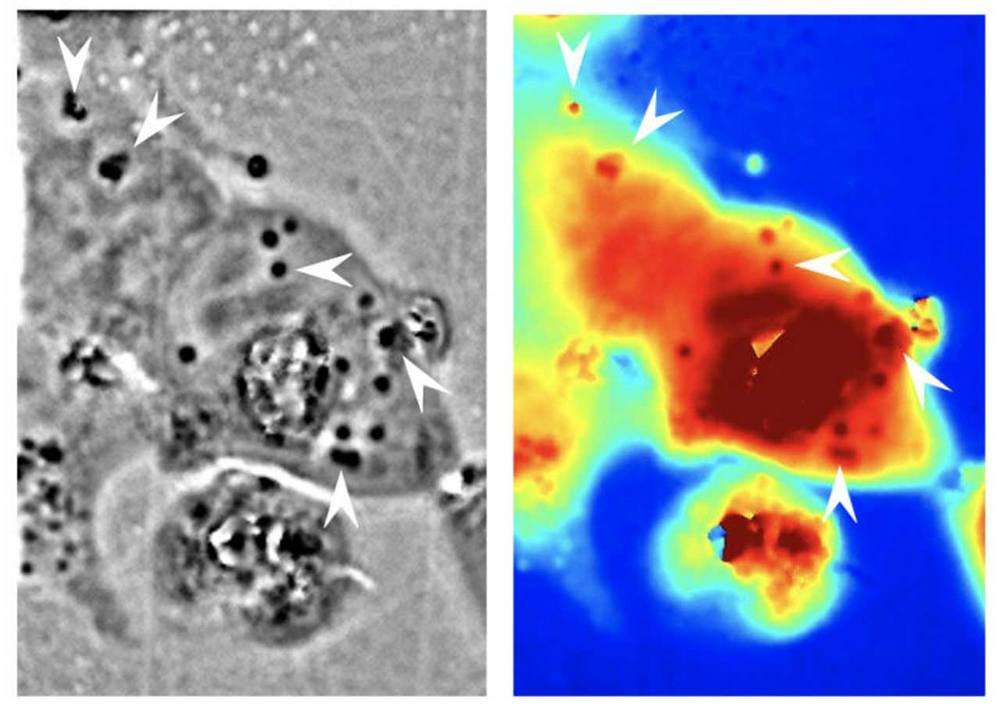 Na imagem do microscópio à esquerda é possível ver onde a reflectina estava presente nas células humanas (as regiões escuras, indicadas por setas brancas).