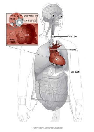 O vírus entra nas células endoteliais dos vasos sanguíneos; a consequente infecção pode provocar de coágulos sanguíneos a ataques cardíacos.