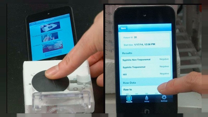 O mChip utiliza o smartphone na realização de testes de HIV