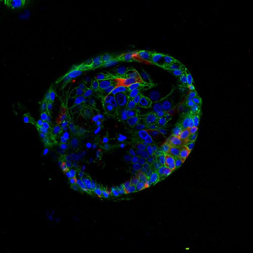 O organoide de células do fígado mostra o ataque do vírus SARS-CoV-2 (em vermelho).