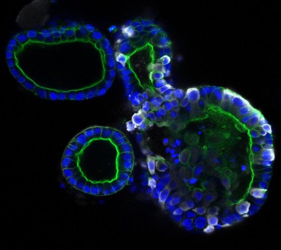Em branco, pode-se distinguir as regiões atacadas pelo coronavírus no organoide intestinal à direita.