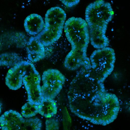 Um organoide intestinal - pode-se notar as vilosidades que absorvem nutrientes no órgão original.