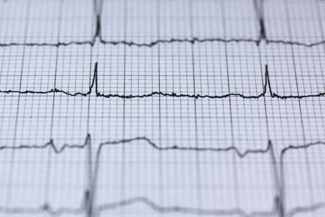 A capacidade de ler o ECG corretamente também ajudou a detectar o problema.