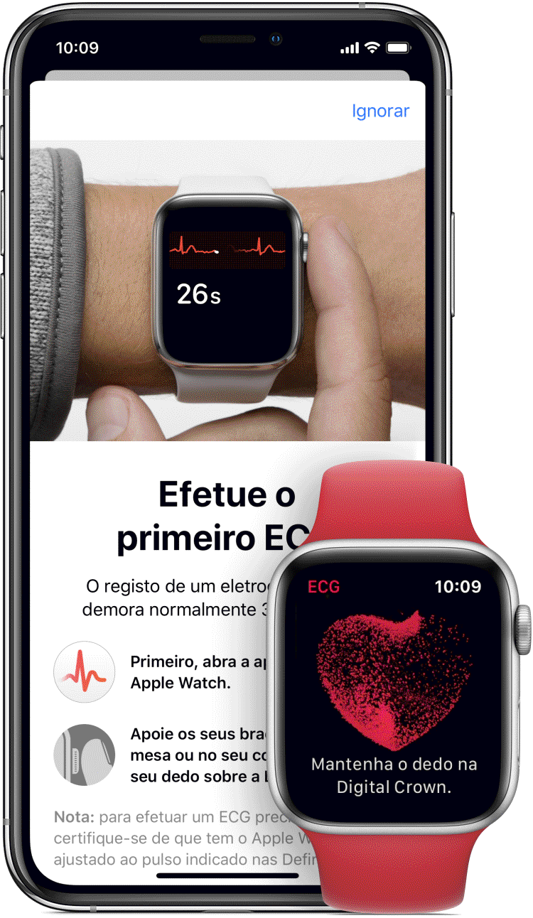 ECG apple watch