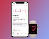 Apple libera iOS 13.6 com eletrocardiograma para Apple Watch no Brasil