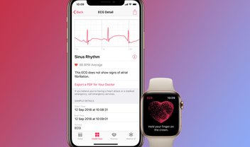 Apple libera iOS 13.6 com eletrocardiograma para Apple Watch no Brasil