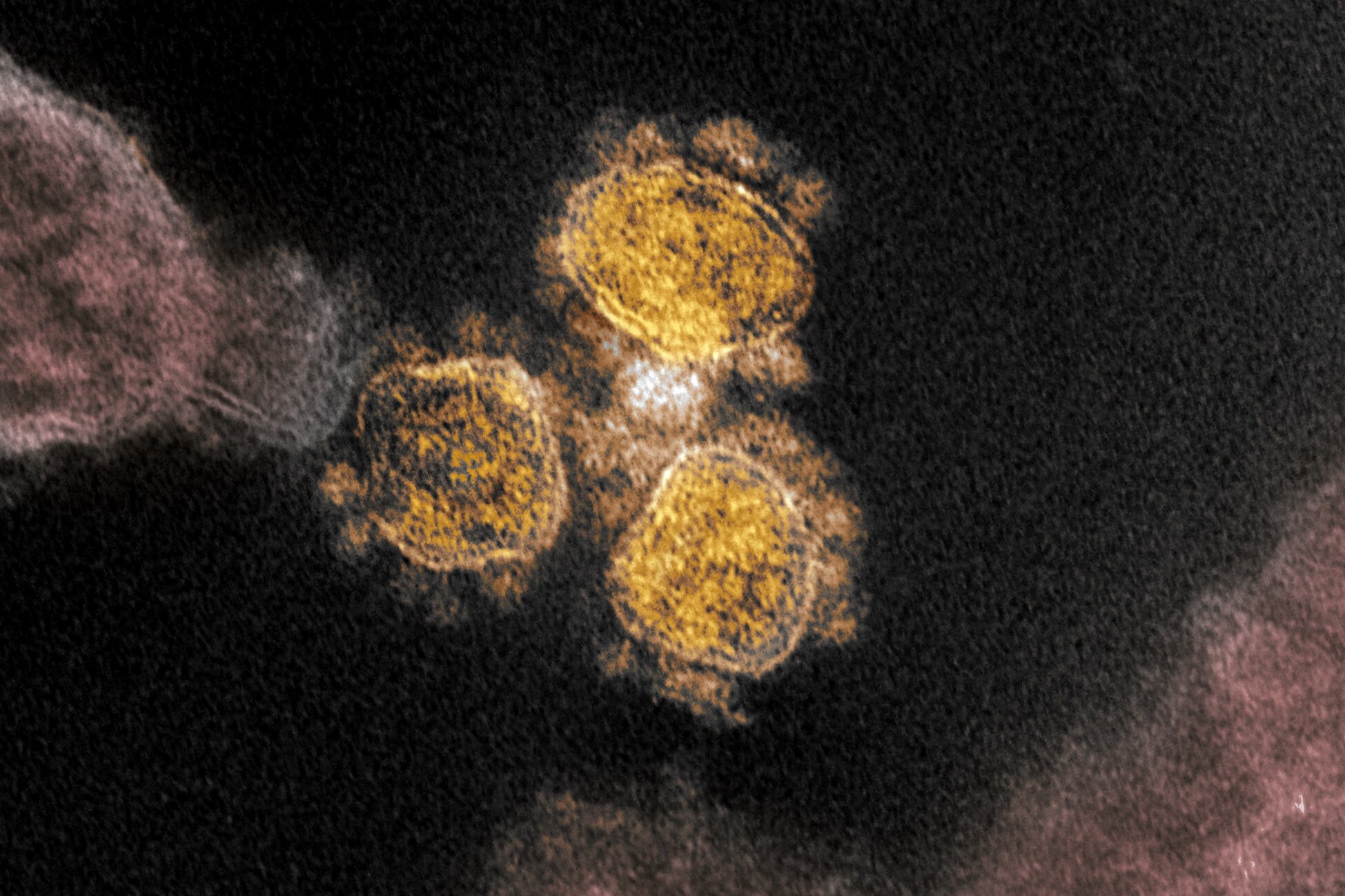 Imagem colorizada do novo coronavírus.