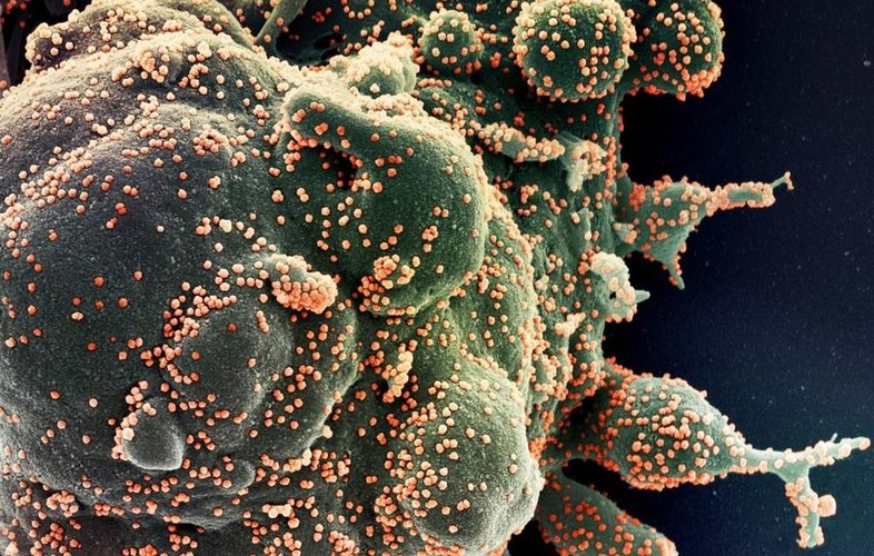 Tratamento com ozonioterapia será testado no Brasil, contra a covid-19.