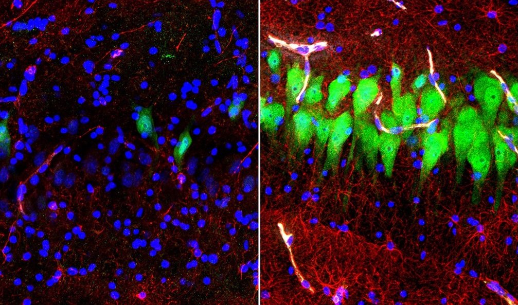 Neurônios (verde), astrócitos (vermelho) e núcleos celulares (azul) no cérebro de um porco se desintegram dez horas depois da morte (à esquerda) ou conseguem sobrevida após a perfusão via BrainEx (à direita).