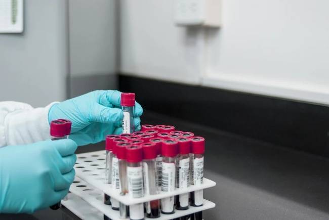 São necessários testes em laboratório para comprovar a reinfecção.