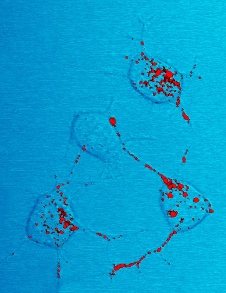 Príons deformadas (em vermelho) contaminam neurônios de camundongo através dos axônios, usados pelas células nervosas para se comunicarem.