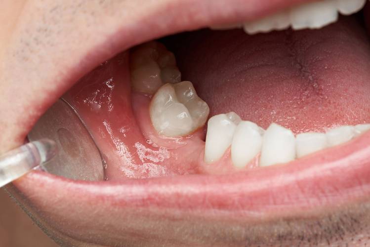 Fonte: Dowell Dental/Reprodução