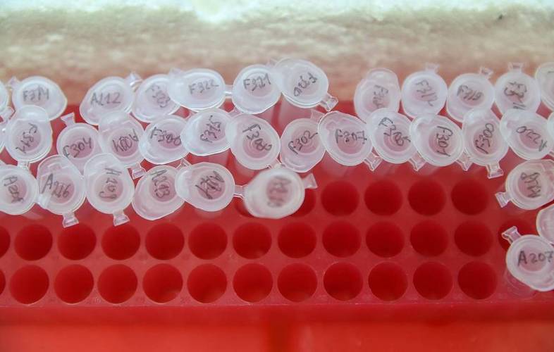Testes in vitro da vacina russa Sputnik, em meados deste ano.