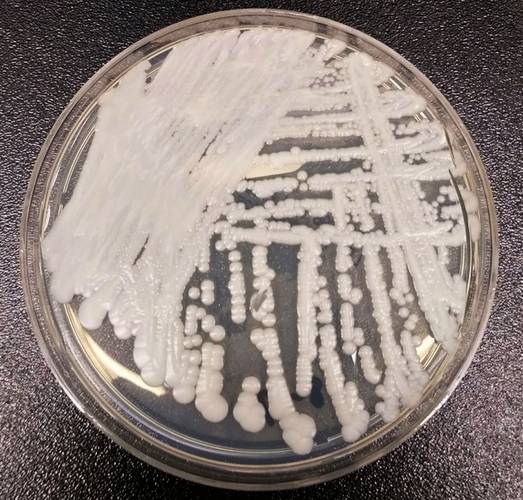 A Candida auris foi identificada pela primeira vez em 2009.
