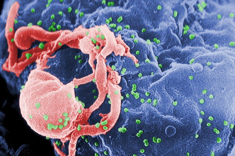 Os vírus HIV saindo de um leufócito. (Imagem: Wikipedia)