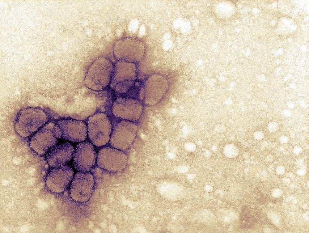 O vírus causador da varíola, doença erradicada do planeta.
