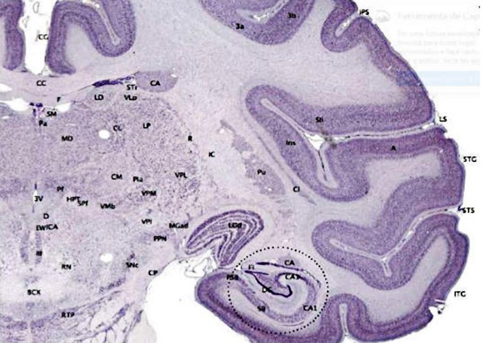 Matéria cinzenta e inteligência conectadas por um gene (Fonte: Fabiano de Abreu/Divulgação)