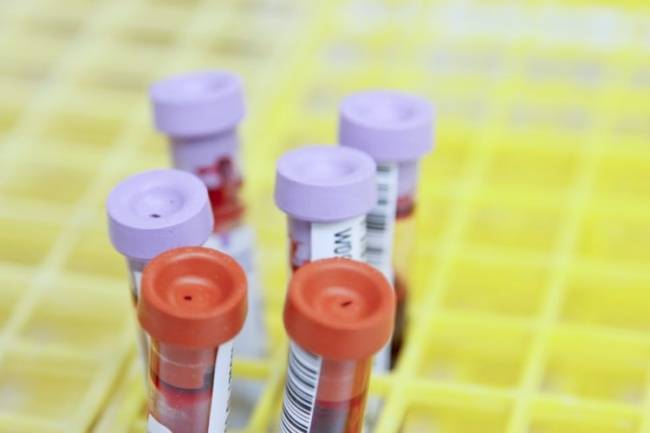 A revisão nos registros de contaminação pelo coronavírus em São Paulo descartaram a presença da cepa do Reino Unido.