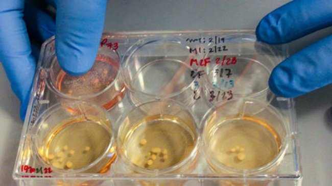 Os minicérebros são cultivados em laboratório para vários estudos.