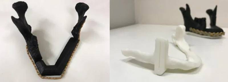 As peças feitas no próprio hospital facilitam testes e simulações do momento da cirurgia.