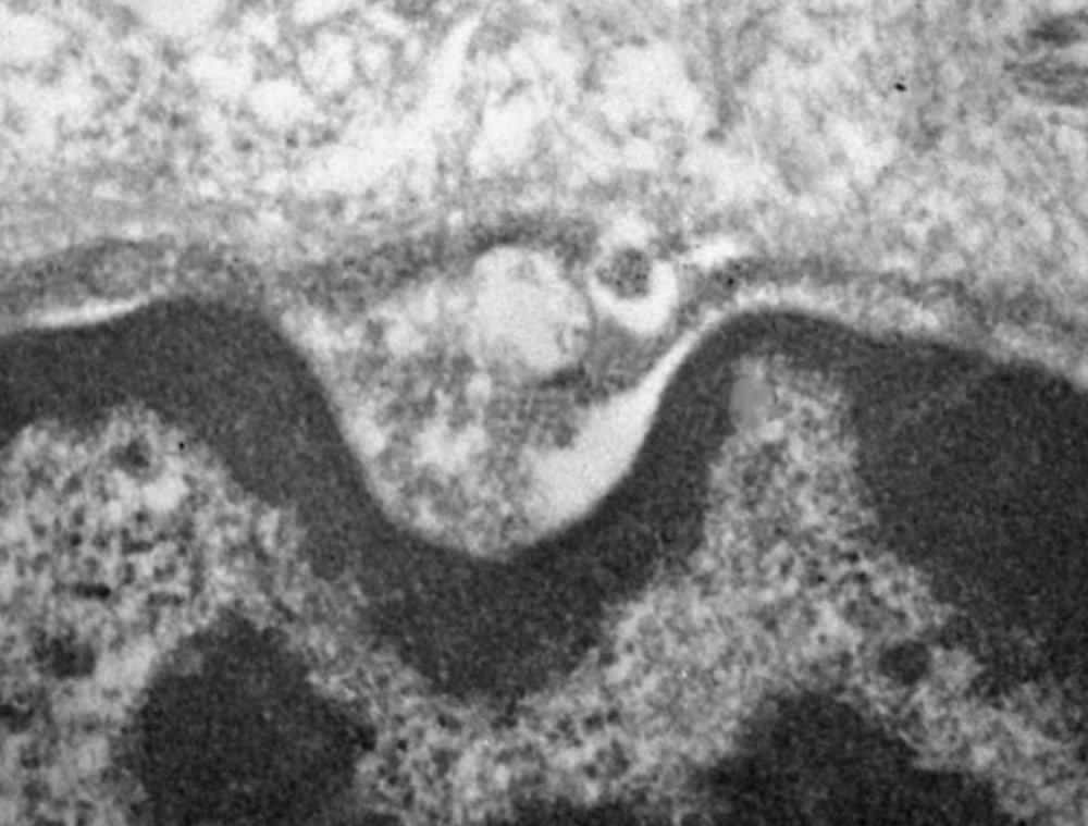 Imagem de microscopia eletrônica mostra o novo coronavírus no interior das glândulas salivares.