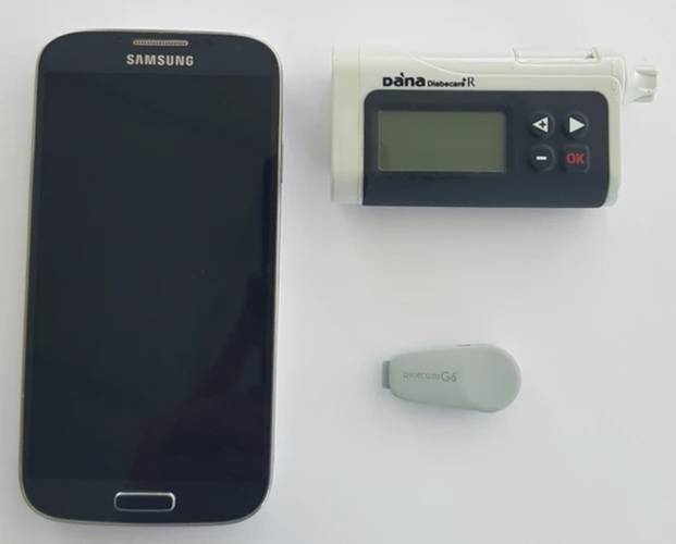 "Pâncreas artificial" é um sistema que tem três componentes: um sensor, uma bomba de insulina e um aplicativo de celular (Fonte: Universidade de Cambrigde/Divulgação)