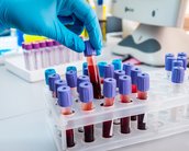 Check-up #2: testes de sangue para câncer e o dano das queimadas à saúde